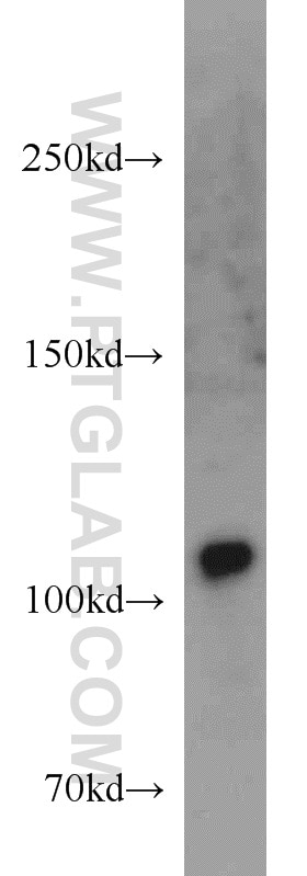 Western Blot (WB) analysis of A549 cells using USP11 Polyclonal antibody (22340-1-AP)