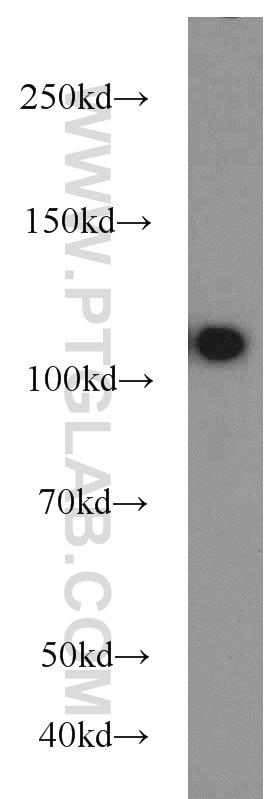 Western Blot (WB) analysis of Jurkat cells using USP11 Polyclonal antibody (22340-1-AP)