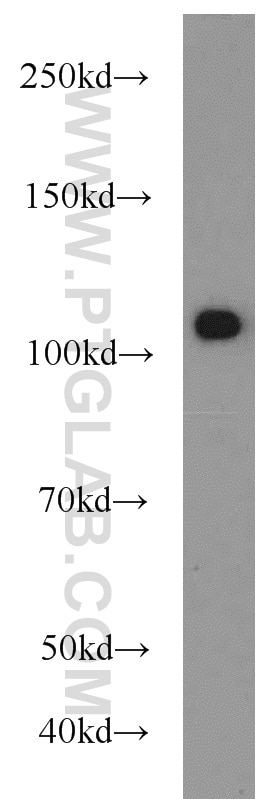 Western Blot (WB) analysis of HEK-293 cells using USP11 Polyclonal antibody (22340-1-AP)