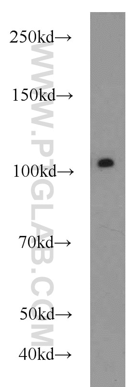 Western Blot (WB) analysis of HEK-293 cells using USP11 Polyclonal antibody (22340-1-AP)