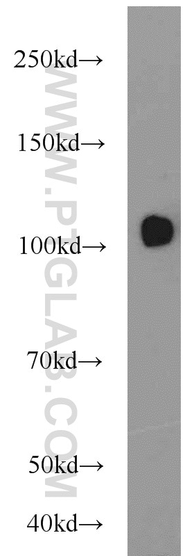 Western Blot (WB) analysis of human testis tissue using USP11 Polyclonal antibody (22340-1-AP)