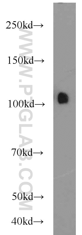 Western Blot (WB) analysis of human testis tissue using USP11 Polyclonal antibody (22340-1-AP)