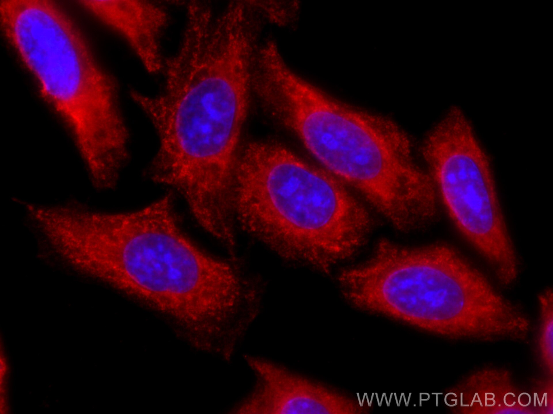 Immunofluorescence (IF) / fluorescent staining of HepG2 cells using CoraLite®594-conjugated USP11 Monoclonal antibody (CL594-67805)