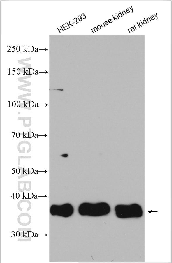 Western Blot (WB) analysis of various lysates using USP12 Polyclonal antibody (12608-1-AP)