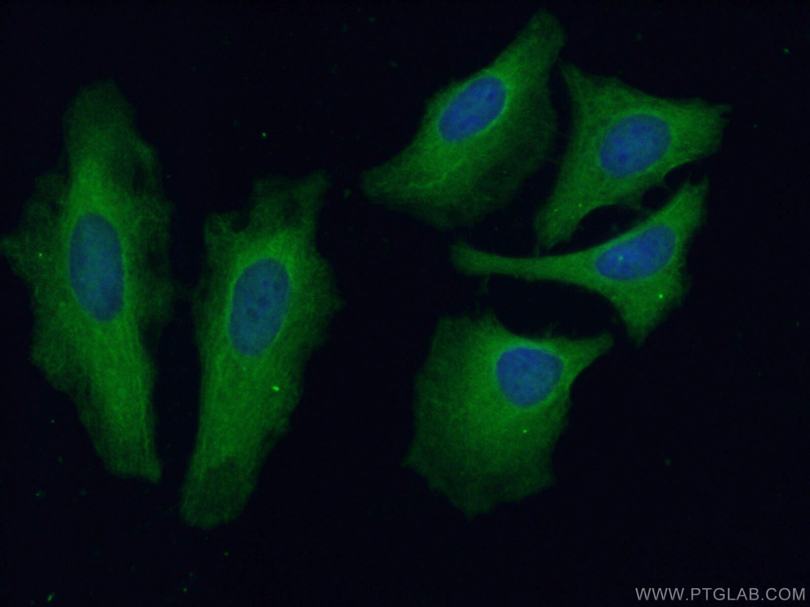 Immunofluorescence (IF) / fluorescent staining of HeLa cells using USP13 Polyclonal antibody (16840-1-AP)