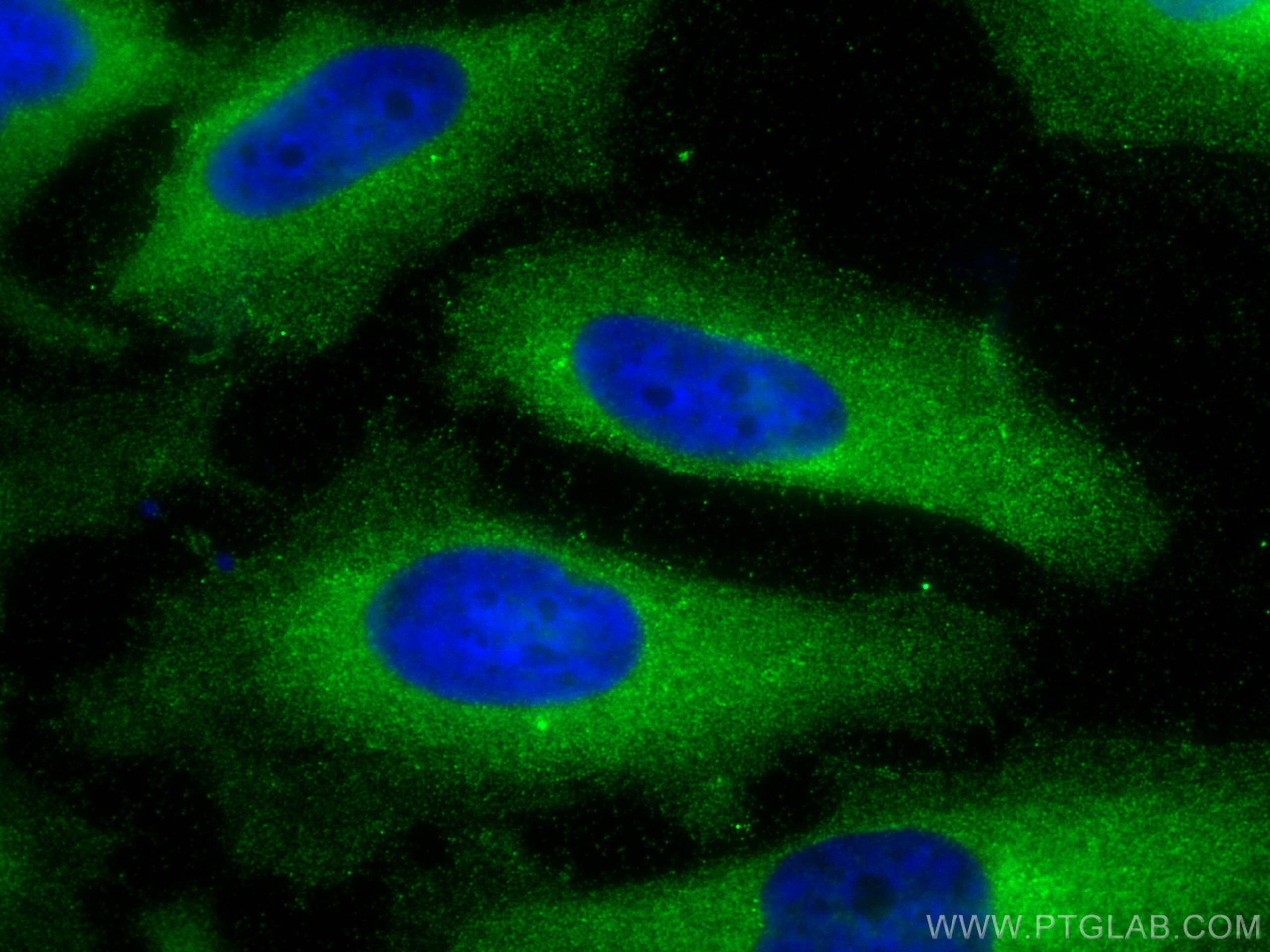 Immunofluorescence (IF) / fluorescent staining of HeLa cells using USP13 Polyclonal antibody (16840-1-AP)
