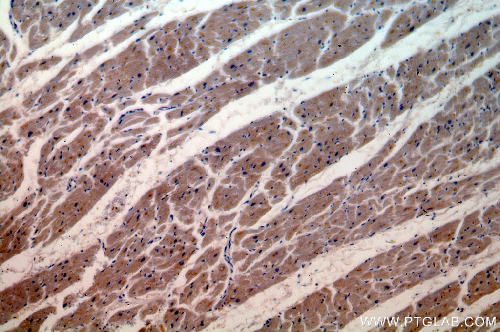 Immunohistochemistry (IHC) staining of human heart tissue using USP13 Polyclonal antibody (16840-1-AP)