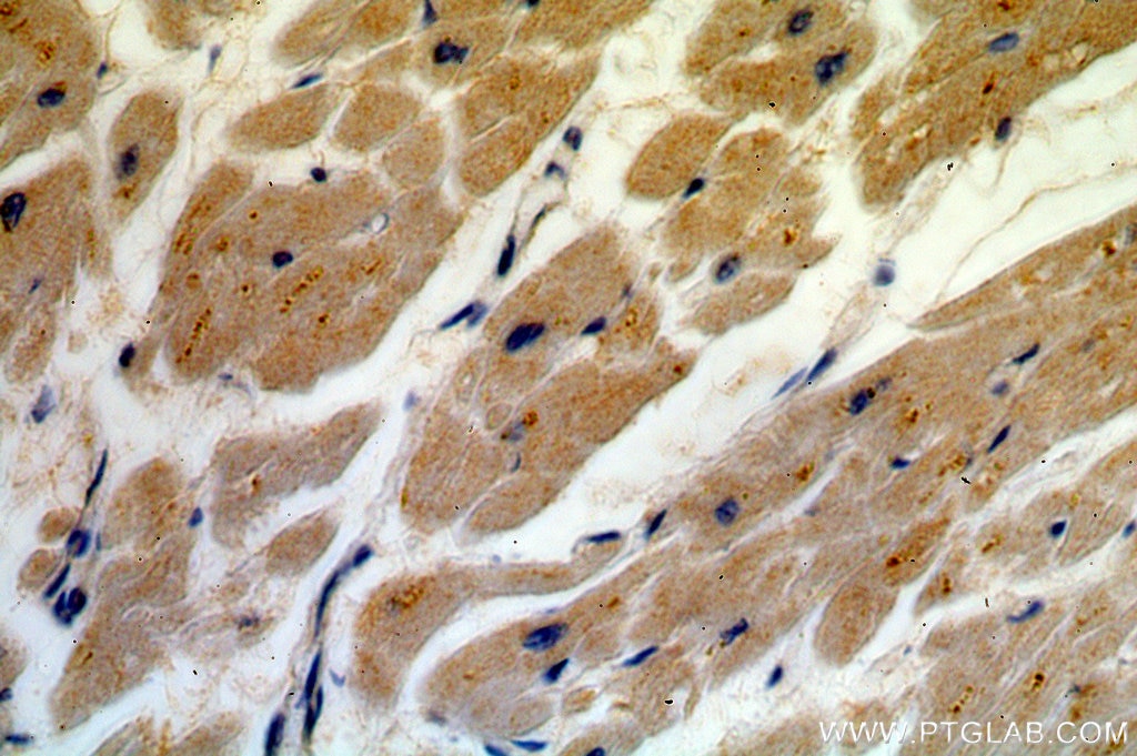 Immunohistochemistry (IHC) staining of human heart tissue using USP13 Polyclonal antibody (16840-1-AP)