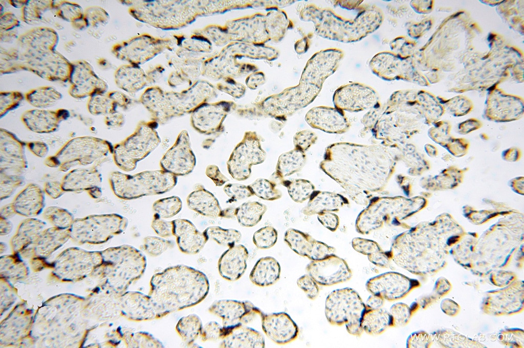 Immunohistochemistry (IHC) staining of human placenta tissue using USP13 Polyclonal antibody (16840-1-AP)