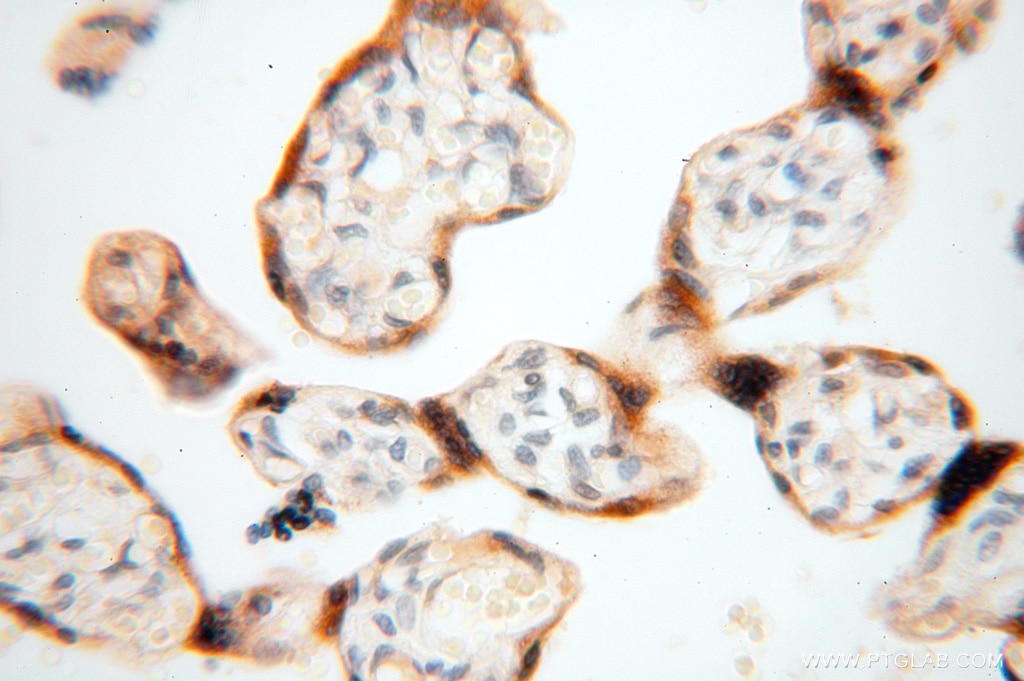 IHC staining of human placenta using 16840-1-AP