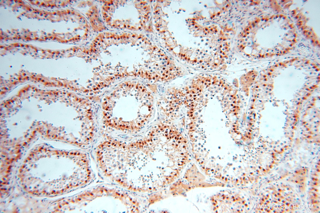 Immunohistochemistry (IHC) staining of human testis tissue using USP13 Polyclonal antibody (16840-1-AP)