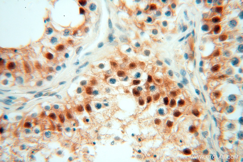 Immunohistochemistry (IHC) staining of human testis tissue using USP13 Polyclonal antibody (16840-1-AP)