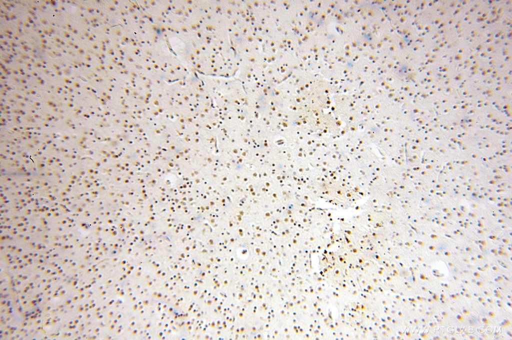 Immunohistochemistry (IHC) staining of human brain tissue using USP13 Polyclonal antibody (16840-1-AP)