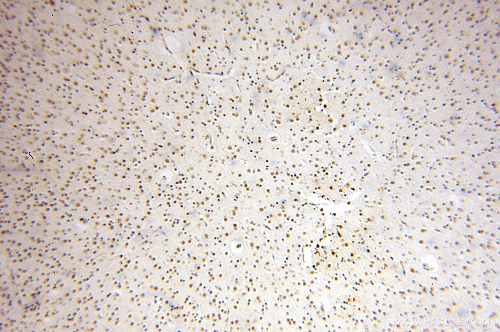 IHC staining of human brain using 16840-1-AP