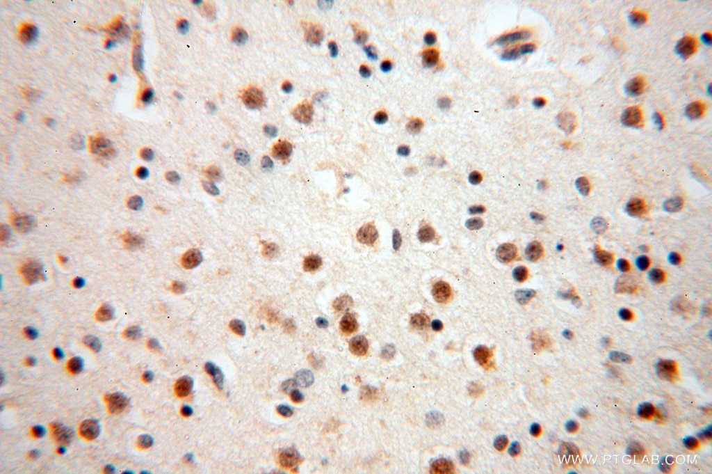 IHC staining of human brain using 16840-1-AP