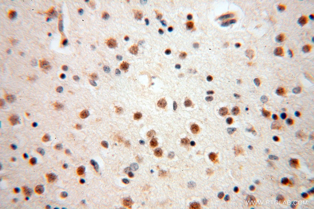 Immunohistochemistry (IHC) staining of human brain tissue using USP13 Polyclonal antibody (16840-1-AP)