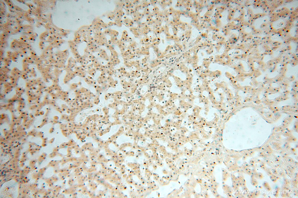 Immunohistochemistry (IHC) staining of human liver tissue using USP13 Polyclonal antibody (16840-1-AP)