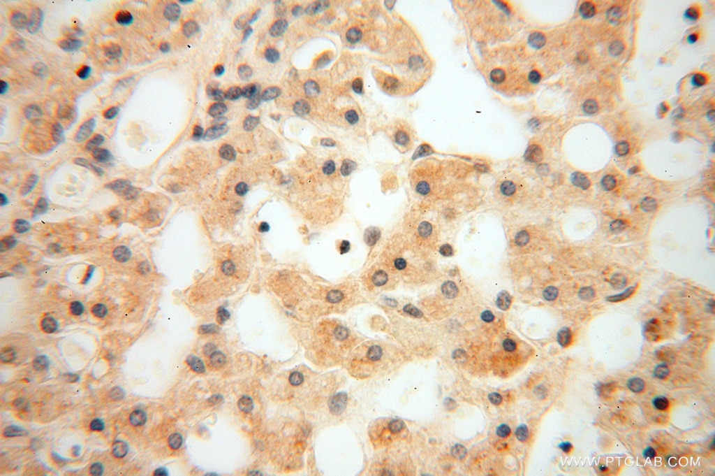 Immunohistochemistry (IHC) staining of human liver tissue using USP13 Polyclonal antibody (16840-1-AP)