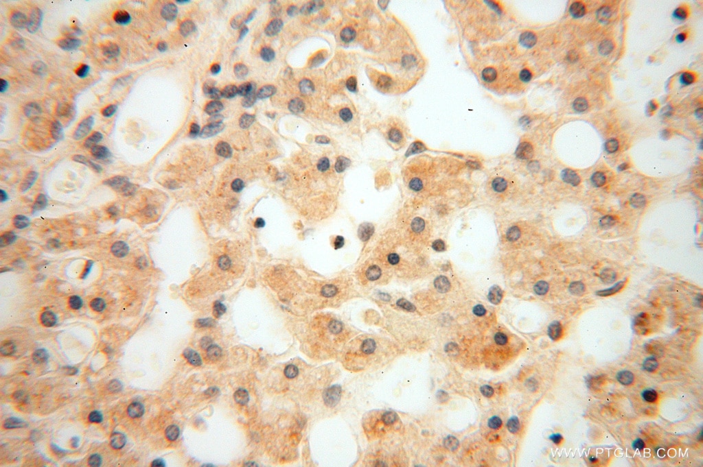 IHC staining of human liver using 16840-1-AP