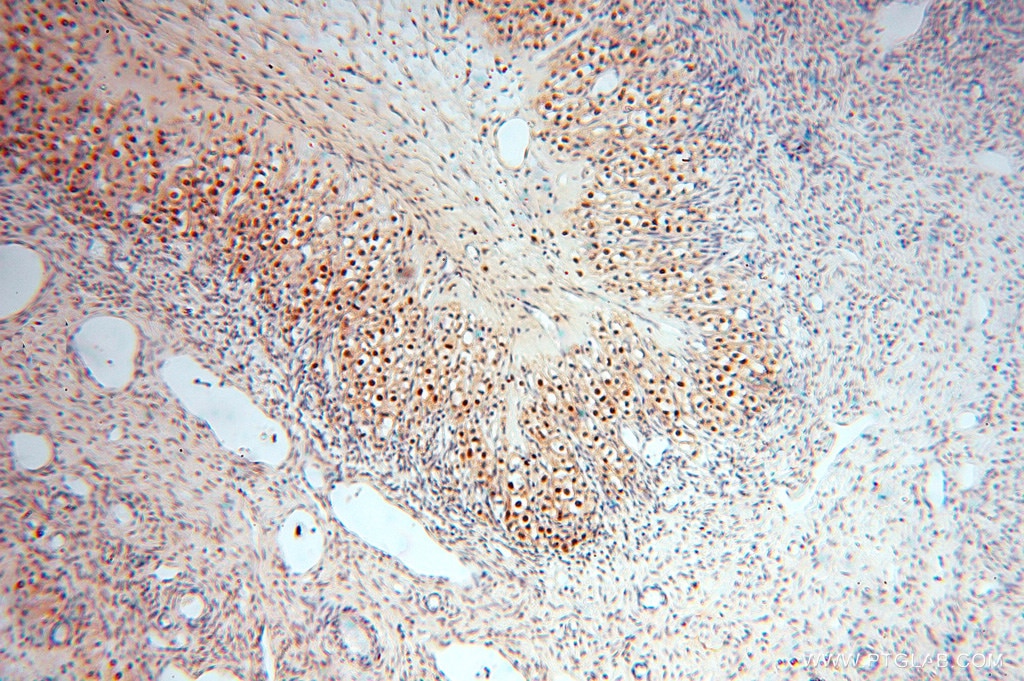 Immunohistochemistry (IHC) staining of human ovary tissue using USP13 Polyclonal antibody (16840-1-AP)
