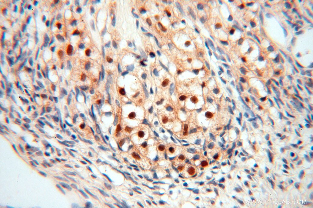 IHC staining of human ovary using 16840-1-AP