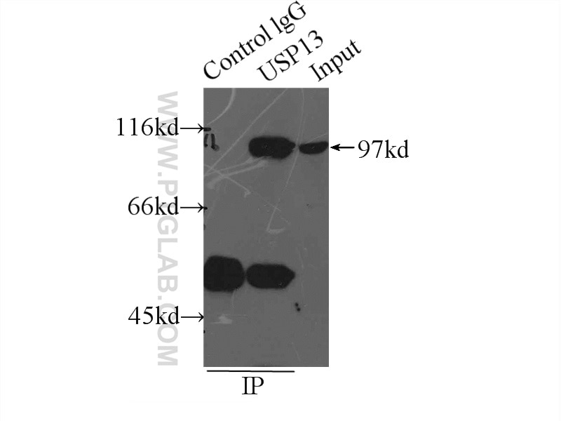 Immunoprecipitation (IP) experiment of HeLa cells using USP13 Polyclonal antibody (16840-1-AP)