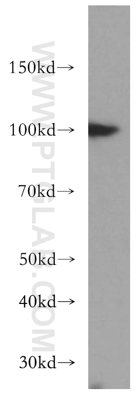 Western Blot (WB) analysis of mouse testis tissue using USP13 Polyclonal antibody (16840-1-AP)