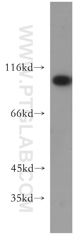 Western Blot (WB) analysis of HeLa cells using USP13 Polyclonal antibody (16840-1-AP)