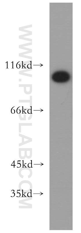 Western Blot (WB) analysis of A375 cells using USP13 Polyclonal antibody (16840-1-AP)