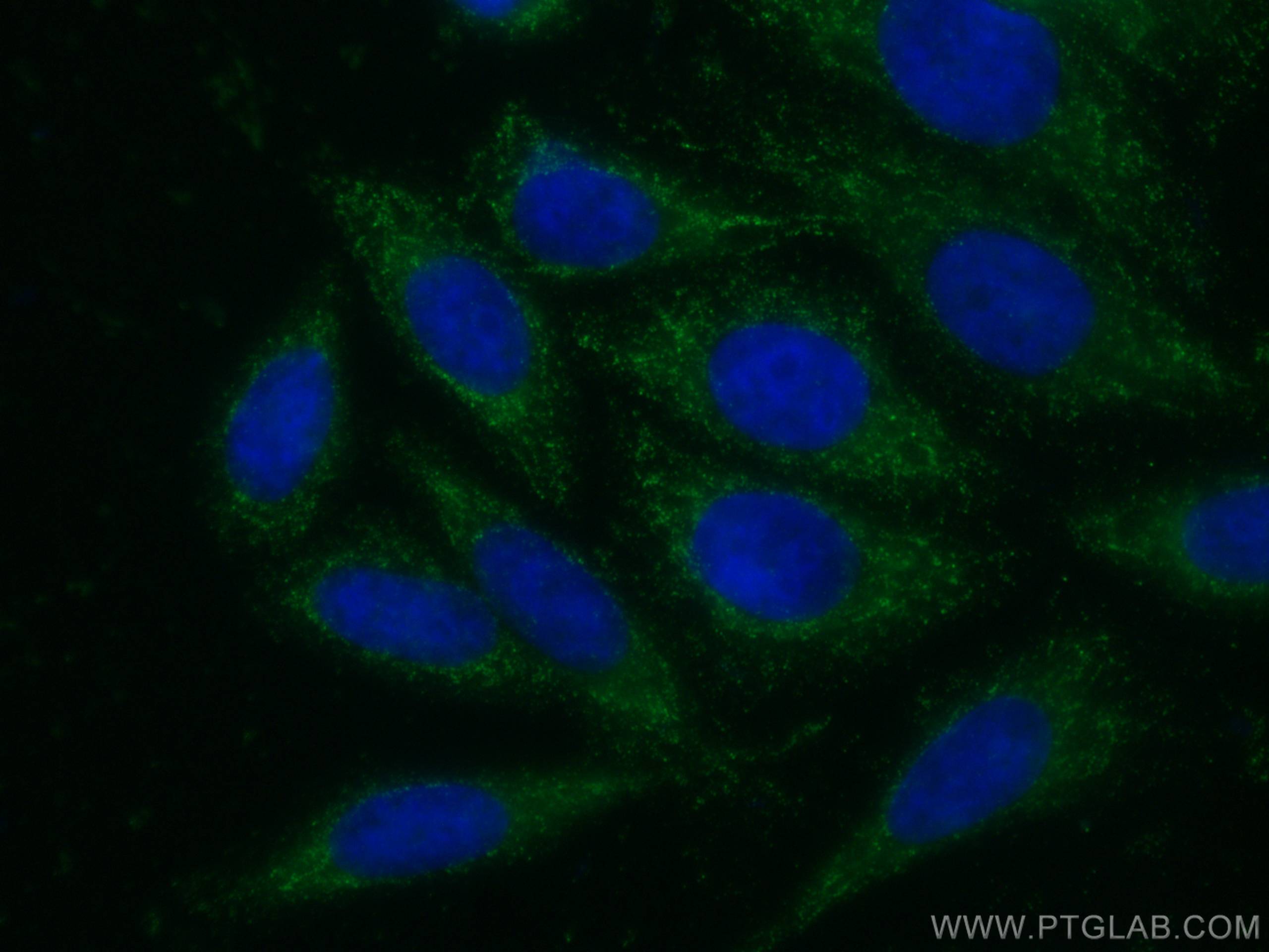 Immunofluorescence (IF) / fluorescent staining of HepG2 cells using USP13 Monoclonal antibody (66176-1-Ig)