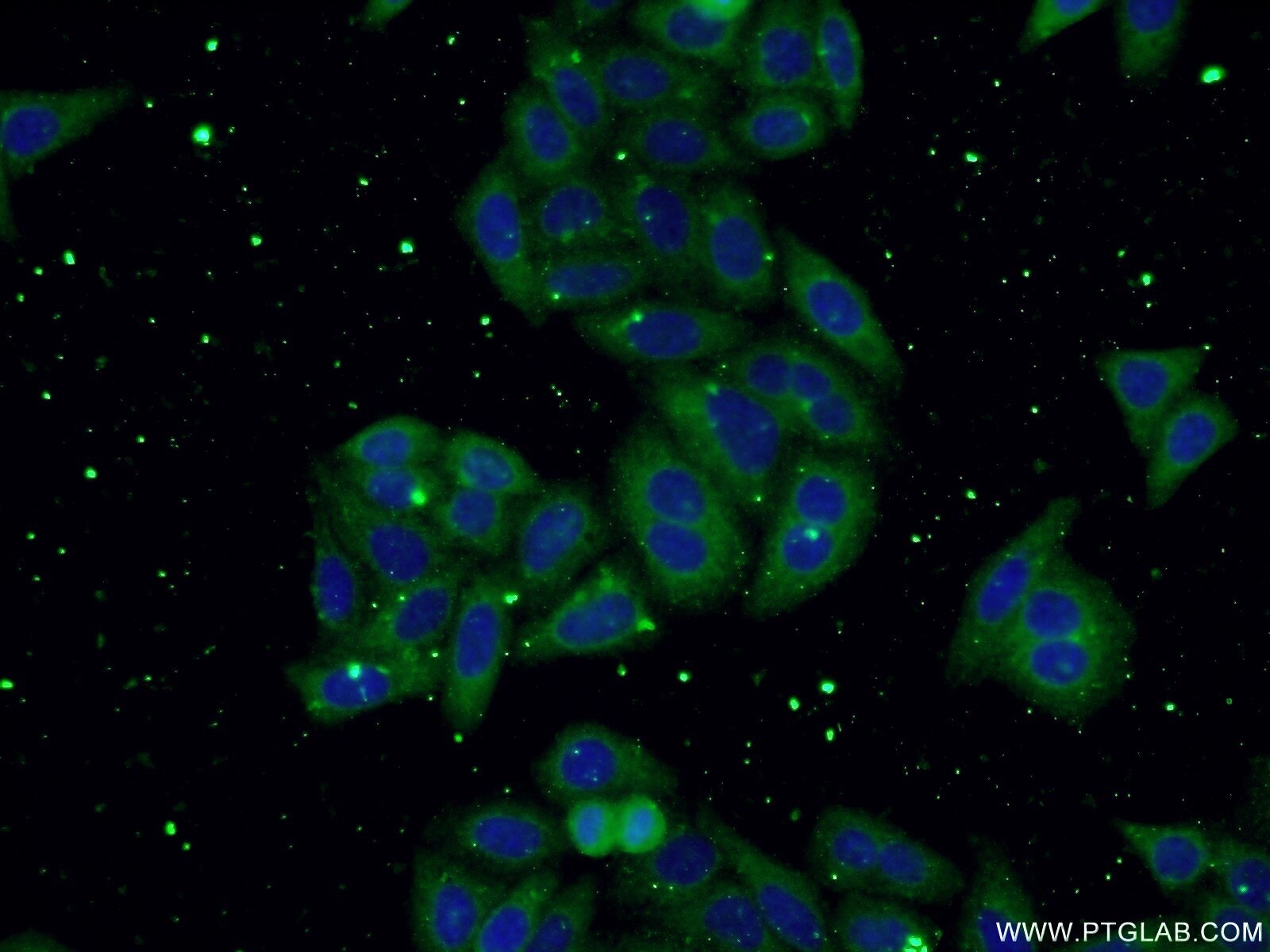 IF Staining of HepG2 using 66176-1-Ig