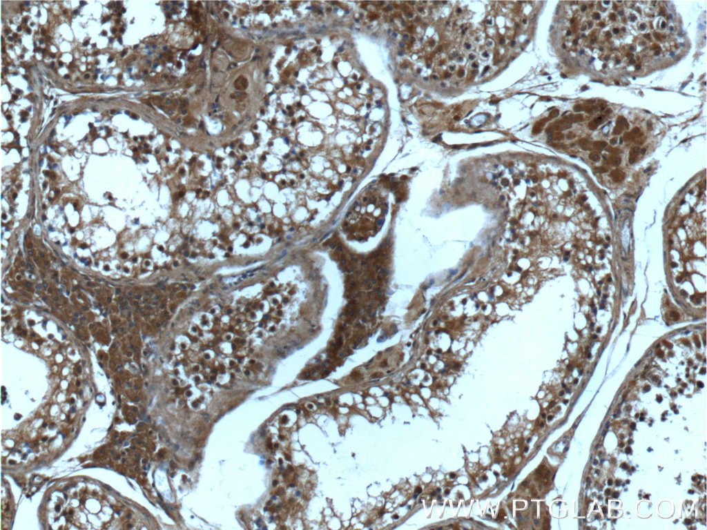 Immunohistochemistry (IHC) staining of human testis tissue using USP13 Monoclonal antibody (66176-1-Ig)