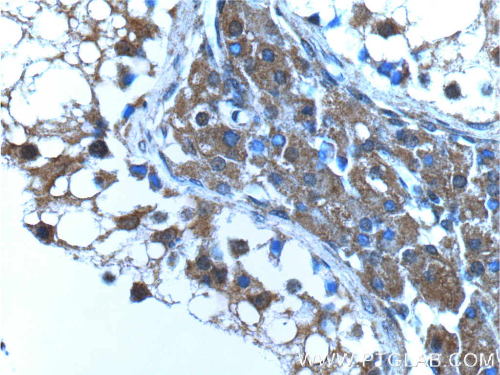 Immunohistochemistry (IHC) staining of human testis tissue using USP13 Monoclonal antibody (66176-1-Ig)