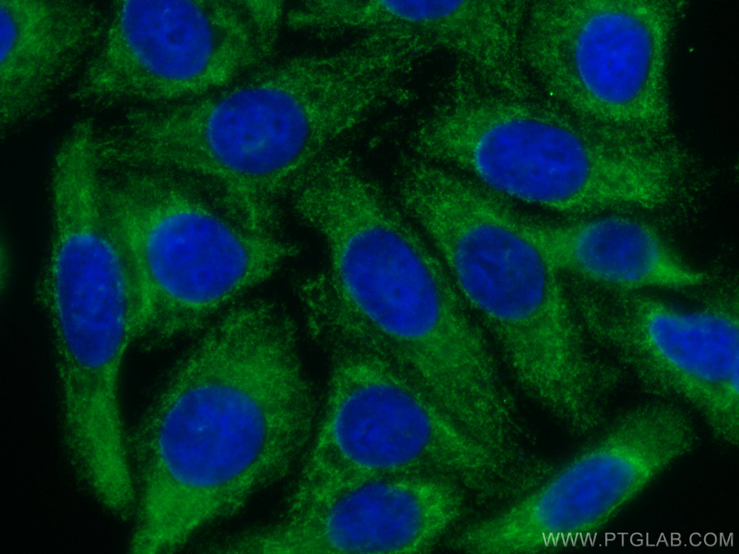 Immunofluorescence (IF) / fluorescent staining of HepG2 cells using CoraLite® Plus 488-conjugated USP13 Monoclonal ant (CL488-66176)
