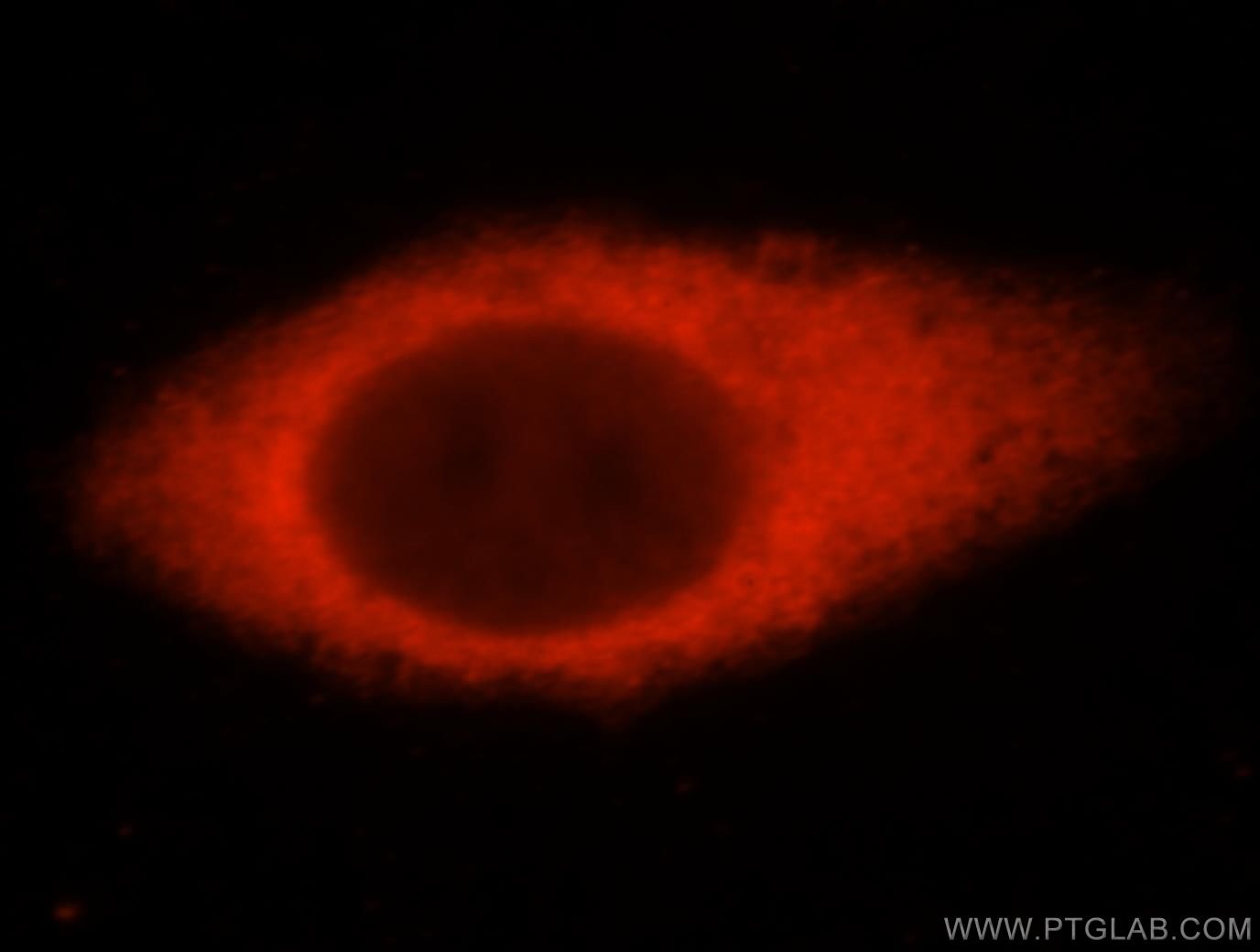Immunofluorescence (IF) / fluorescent staining of HepG2 cells using USP14 Polyclonal antibody (14517-1-AP)