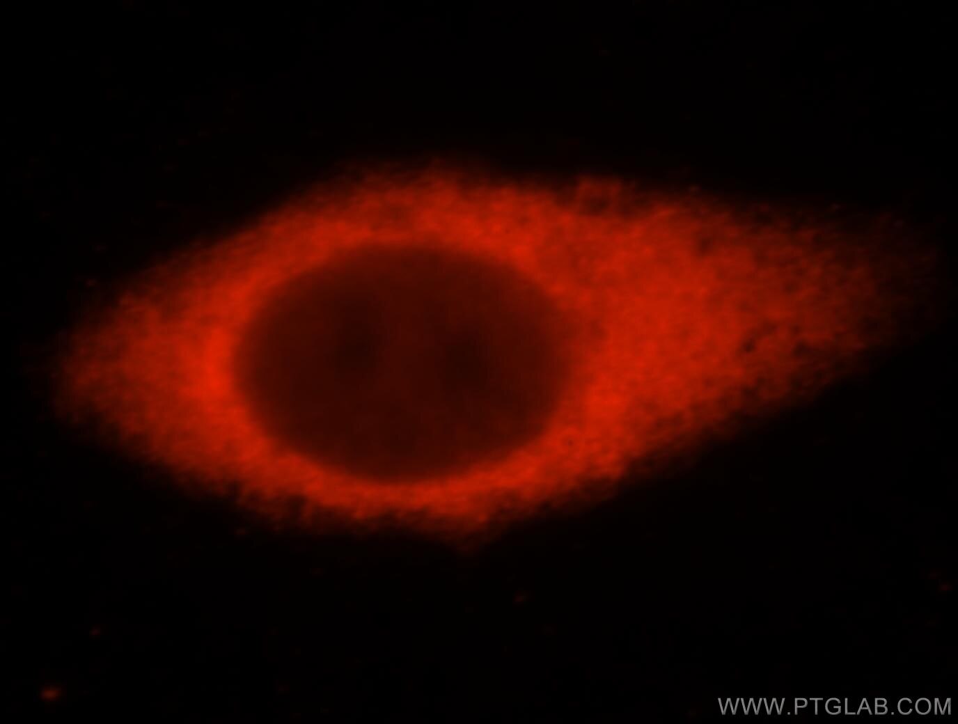 IF Staining of HepG2 using 14517-1-AP