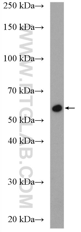 Western Blot (WB) analysis of HeLa cells using USP14 Polyclonal antibody (14517-1-AP)