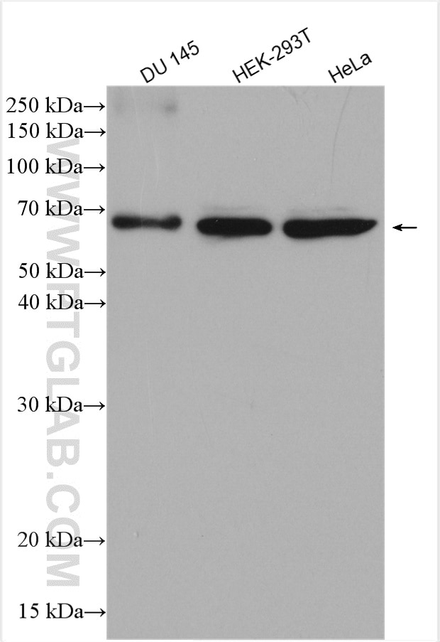 Western Blot (WB) analysis of various lysates using USP14 Polyclonal antibody (14517-1-AP)