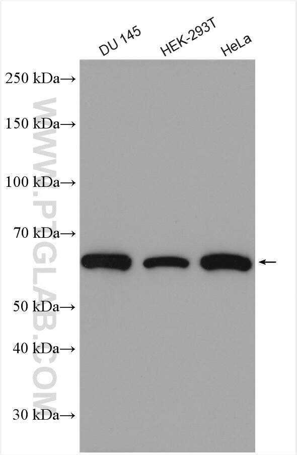 Western Blot (WB) analysis of various lysates using USP14 Polyclonal antibody (14517-1-AP)