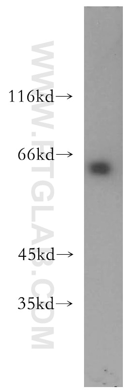 Western Blot (WB) analysis of mouse heart tissue using USP14 Polyclonal antibody (14517-1-AP)