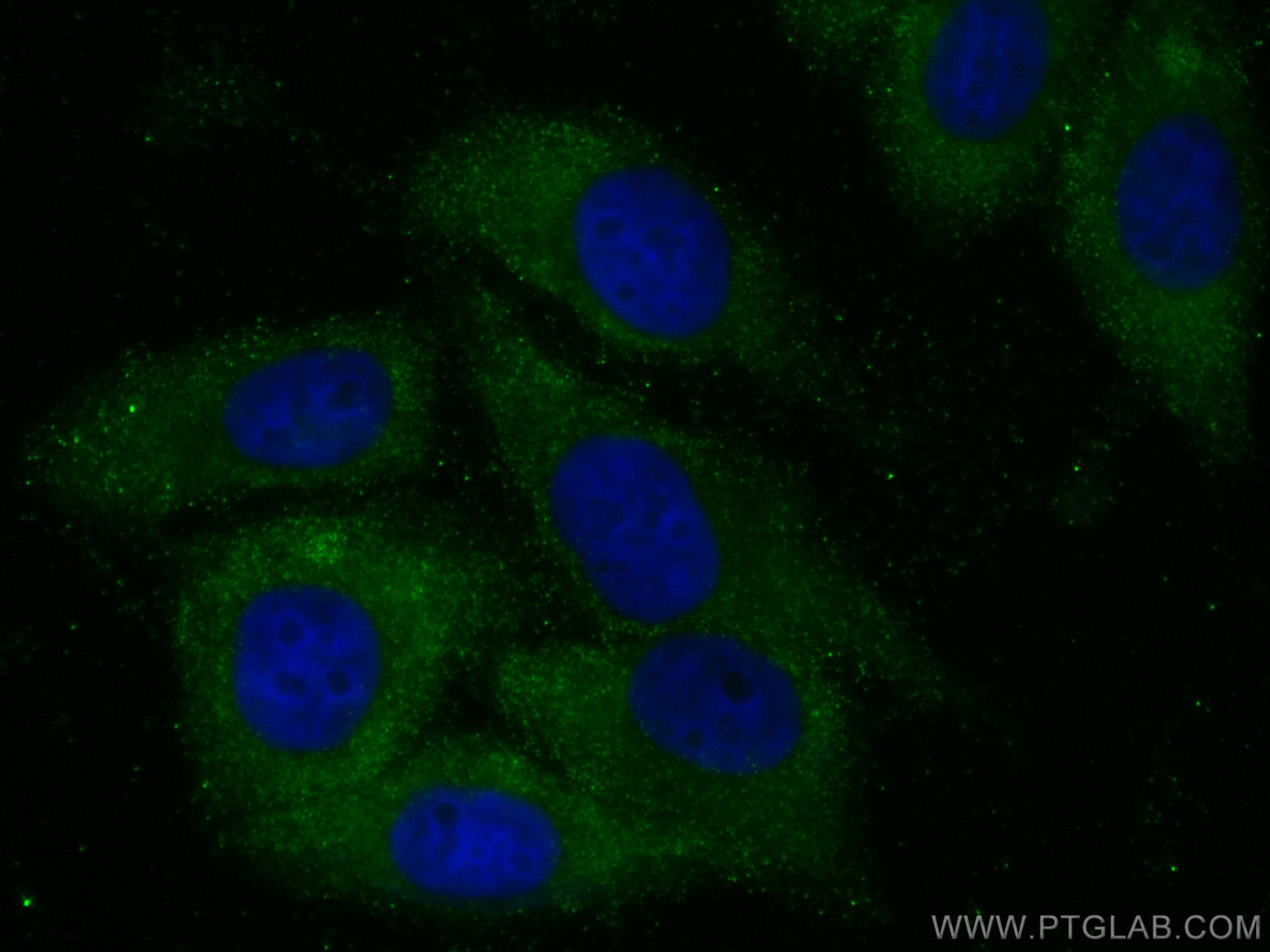 Immunofluorescence (IF) / fluorescent staining of HepG2 cells using USP14 Monoclonal antibody (67746-1-Ig)