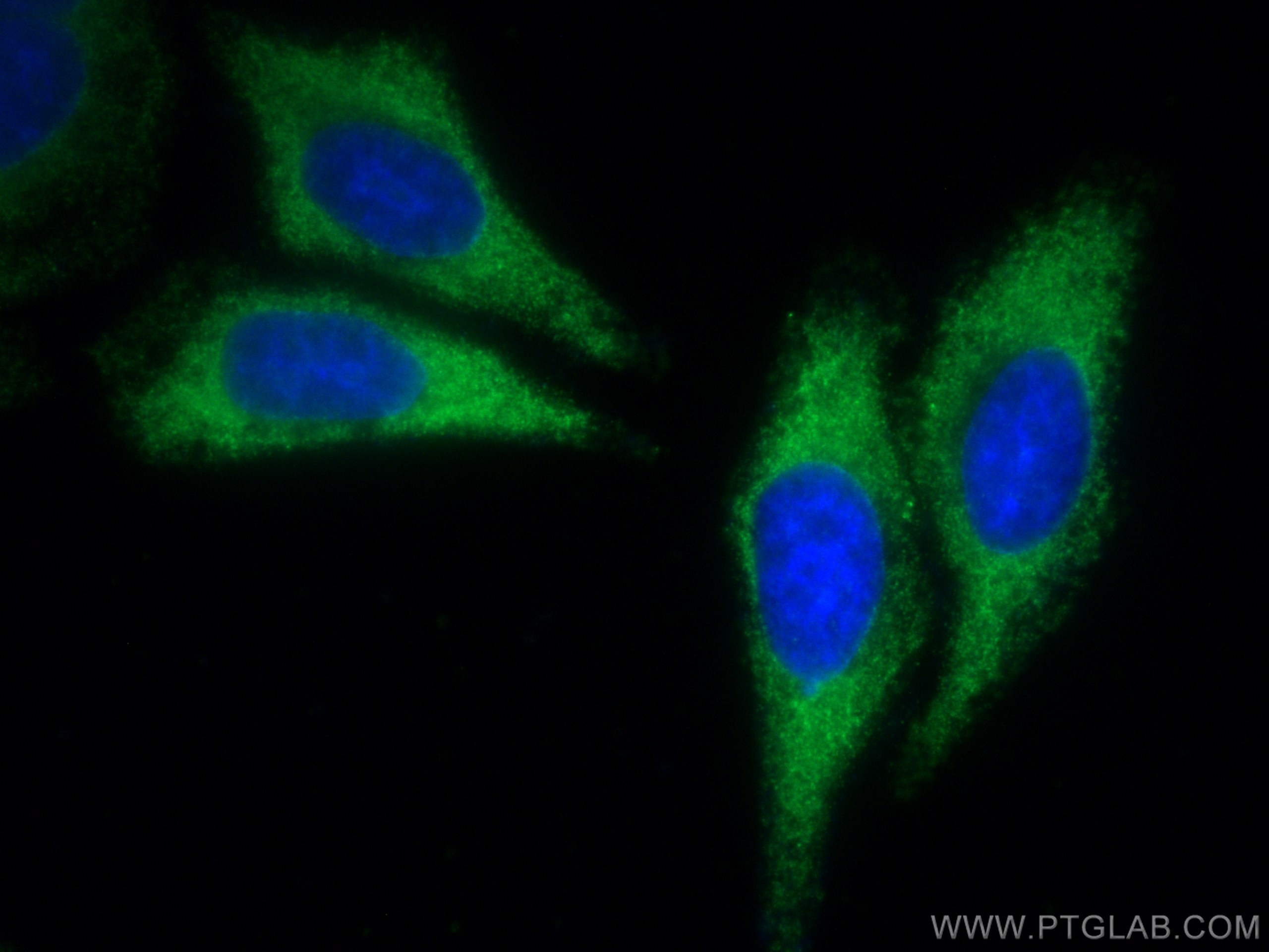 Immunofluorescence (IF) / fluorescent staining of HepG2 cells using CoraLite® Plus 488-conjugated USP14 Monoclonal ant (CL488-67746)