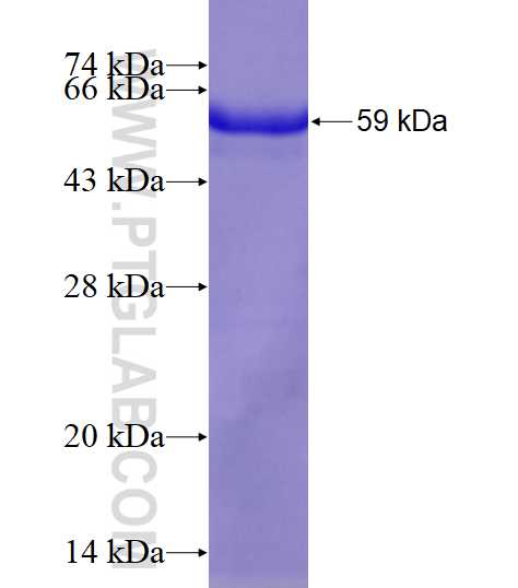USP14 fusion protein Ag5979 SDS-PAGE