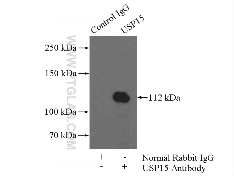 Immunoprecipitation (IP) experiment of mouse brain tissue using USP15 Polyclonal antibody (14354-1-AP)