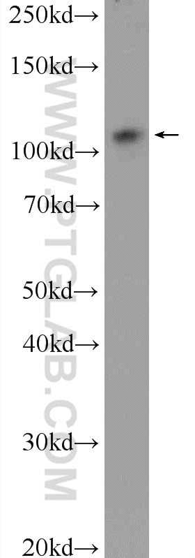 Western Blot (WB) analysis of HEK-293 cells using USP15 Polyclonal antibody (14354-1-AP)