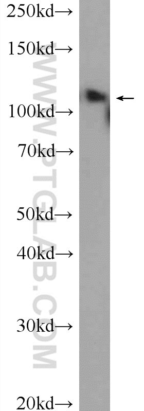 Western Blot (WB) analysis of HeLa cells using USP15 Polyclonal antibody (14354-1-AP)