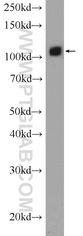 Western Blot (WB) analysis of mouse brain tissue using USP15 Polyclonal antibody (14354-1-AP)