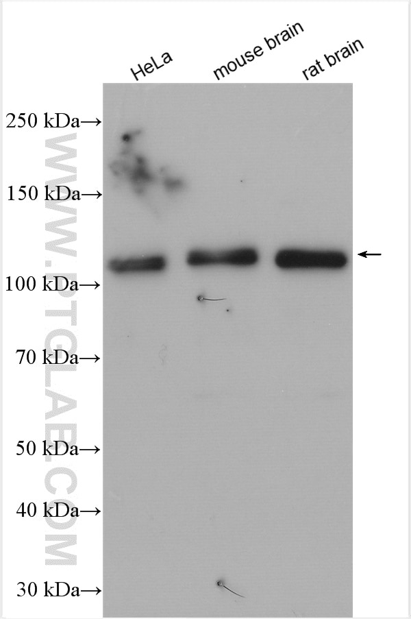 Western Blot (WB) analysis of various lysates using USP15 Polyclonal antibody (14354-1-AP)