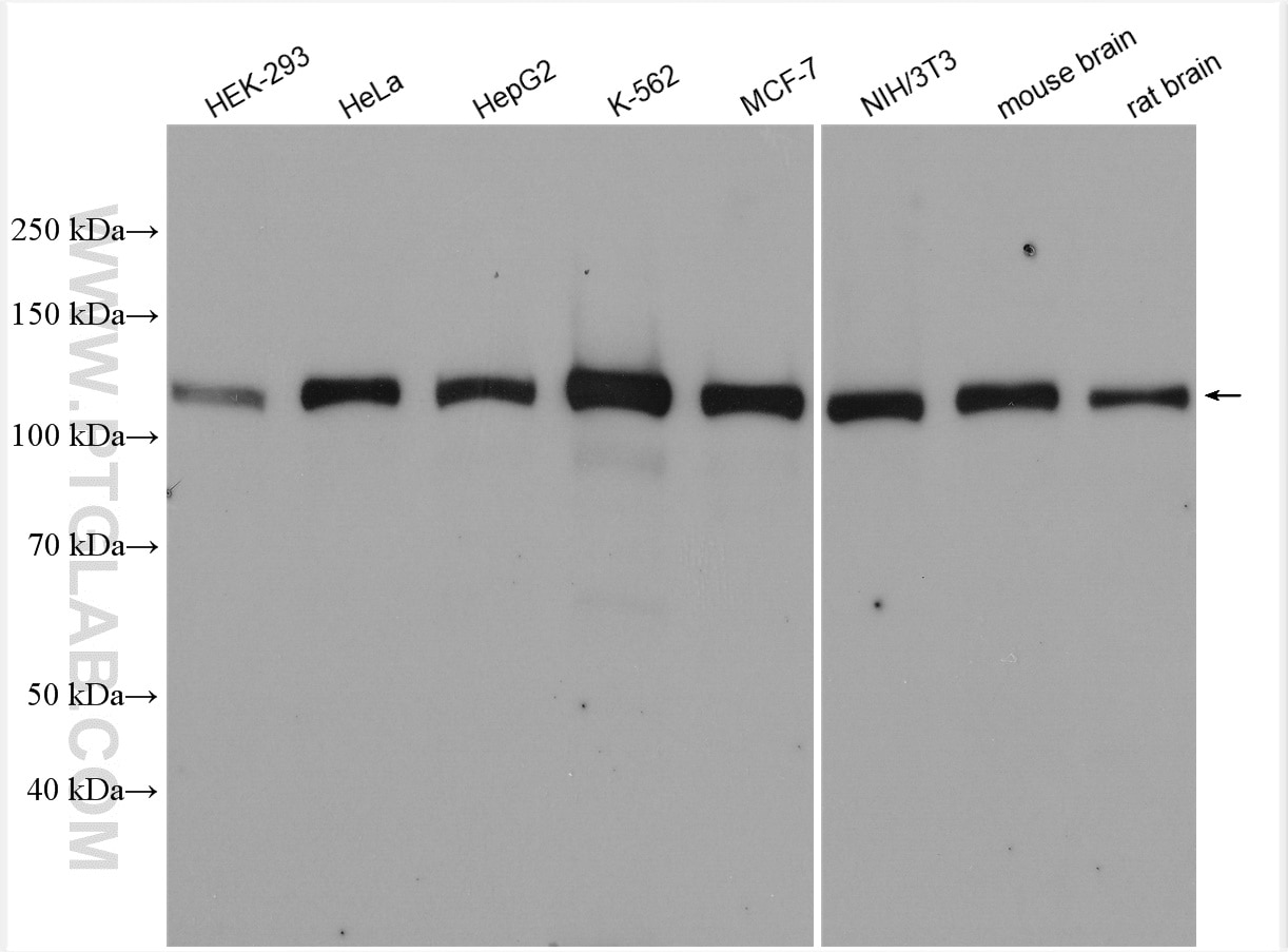 Western Blot (WB) analysis of various lysates using USP15 Polyclonal antibody (14354-1-AP)