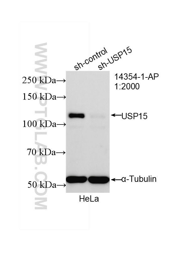Western Blot (WB) analysis of HeLa cells using USP15 Polyclonal antibody (14354-1-AP)